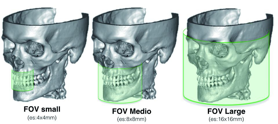 Indicaciones Para Un Uso Consciente De Cbct Tomografía Computarizada