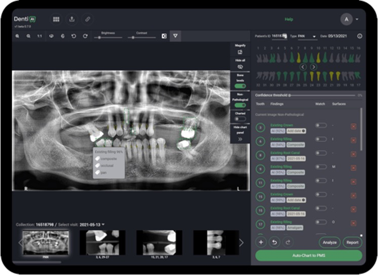 Inteligencia Artificial En Odontolog A Una Realidad En Constante Evoluci N