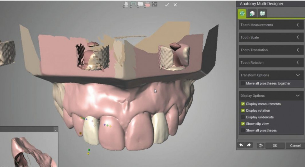 FIG4_CASO SEPA_PERIODONCIA_D4.0_DM61