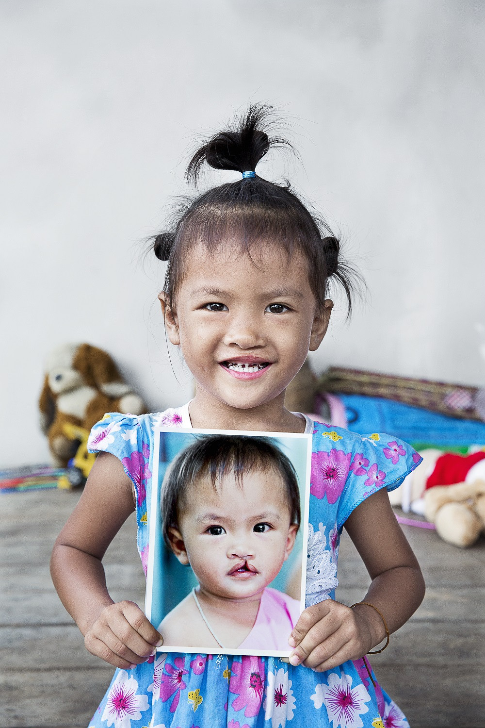 Operation Smile (2)