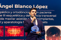 Recogiendo el Premio Sanitas Dental Star 2024 2